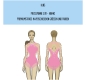 Preview: KL05